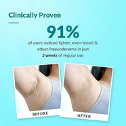 Fixderma Nigrifix Underarm Ocean Roll on With 6% AHA, Lactic Acid & 1% Mandelic Acid & Kojic Acid | Brightens Skin & Exfoliates Underarm | For Sensitive Skin - 60ml