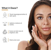 Fixderma 2% Kojic Acid + 1% Arbutin Skarfix-Plus Scar Removal Cream | Hyperpigmentation Removal Cream and Acne Scars Removal Cream | Helps to Reduce Melasma- 15 g