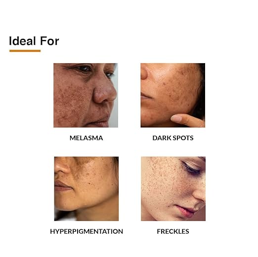 Fixderma 2% Kojic Acid + 1% Arbutin Skarfix-Plus Scar Removal Cream | Hyperpigmentation Removal Cream and Acne Scars Removal Cream | Helps to Reduce Melasma- 15 g