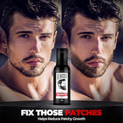 Beardo Beard and Hair Growth Oil - 50 ml for faster beard growth and thicker looking beard