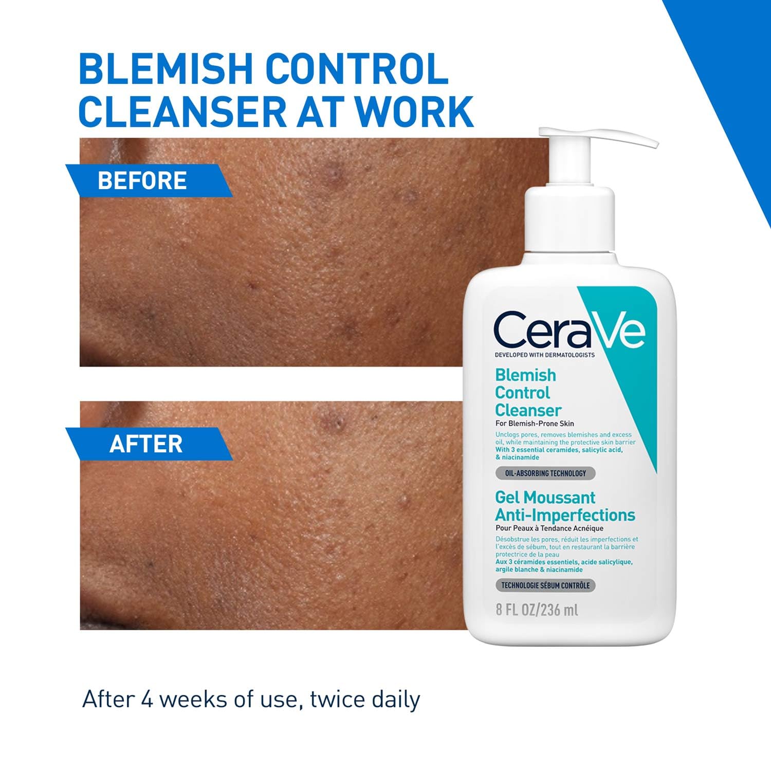 CeraVe Blemish Control Cleanser with 2% Salicylic Acid & Niacinamide for Acne Prone Skin 236ml