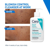 CeraVe Blemish Control Cleanser with 2% Salicylic Acid & Niacinamide for Acne Prone Skin 236ml