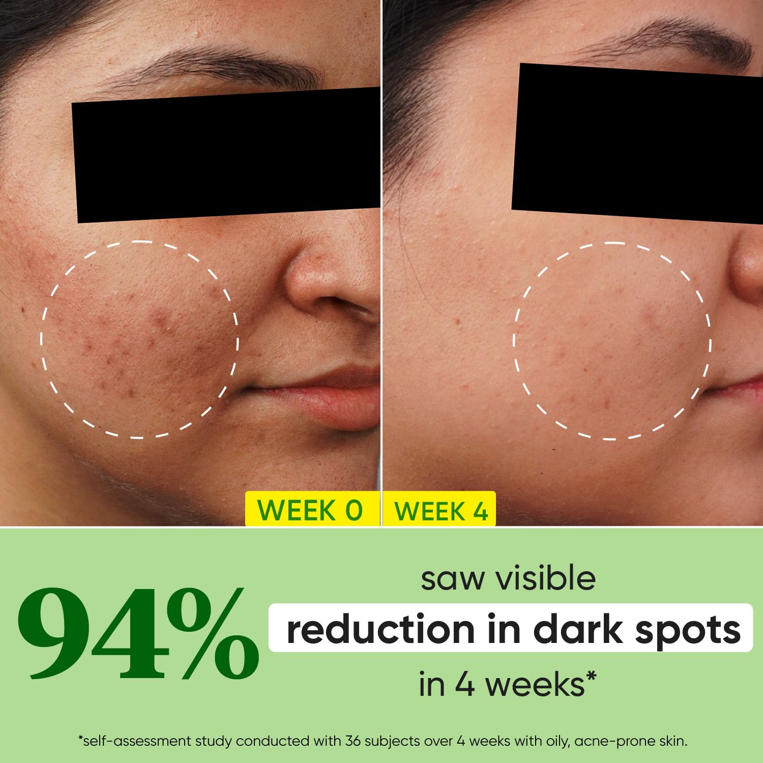 Dot & Key 10% Niacinamide + Cica Serum | Reduces Acne & Dark Spots | Niacinamide Serum