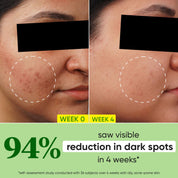 Dot & Key 10% Niacinamide + Cica Serum | Reduces Acne & Dark Spots | Niacinamide Serum