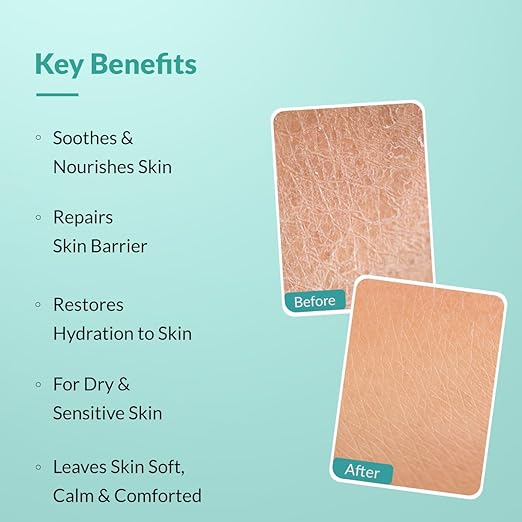 Fixderma Dewrav Body Lotion for Dry & Sensitive Skin with Shea Butter & Ceramides Complex | Deeply Nourishes, Moisturizes & Restores the Skin Barrier | Moisturizer for Men & Women - 250 ml