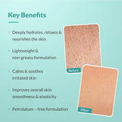 Fixderma Dewrav Moisturizing Cream for Face & Body with Shea Butter | Cold Cream for Winter | Deeply Moisturize, Hydrates & Soften Skin | Soothes Irritation | For Dry to Very Dry Skin - 250g