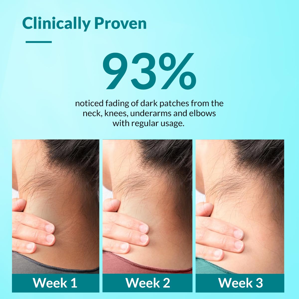 Fixderma Nigrifix Cream for Acanthosis Nigricans with Lactic Acid | Dermatologist Tested Retinol Cream | For Dark Body Parts like Neck, Ankles, Knuckles, Armpits, Thighs & Elbows
