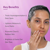 Fixderma Tranexamic Acid Pigment Correcting Serum | Face Serum for Melasma, Hyperpigmentation & Acne Spots | Acne Face Serum for Men & Women-30gm