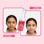 Whimsy Beauty Foaming Face Wash for Kids | Gentle Daily Cleanser with Aloe Vera, Strawberry and Vitamin B3 | Tear Free, Non Drying | Dermatologist Tested | Safe for Sensitive Skin | 4 to16 Years | 100 ml