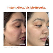 Foxtale Vitamin C Super Glow Moisturizer with Niacinamide & Peptides, Visibly Reduces Pigmentation, Enhances Skins Radiance Instantly, For All Skin Types, Women & Men