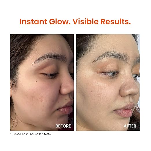 Foxtale Vitamin C Super Glow Moisturizer with Niacinamide & Peptides, Visibly Reduces Pigmentation, Enhances Skins Radiance Instantly, For All Skin Types, Women & Men