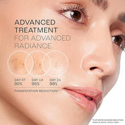 Lakme Perfect Radiance Pigmentation Treatment Serum with 15% Niacinamide Resorcinol Pro Retinol Complex,