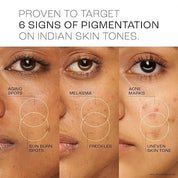 Lakme Perfect Radiance Pigmentation Treatment Serum with 15% Niacinamide Resorcinol Pro Retinol Complex,