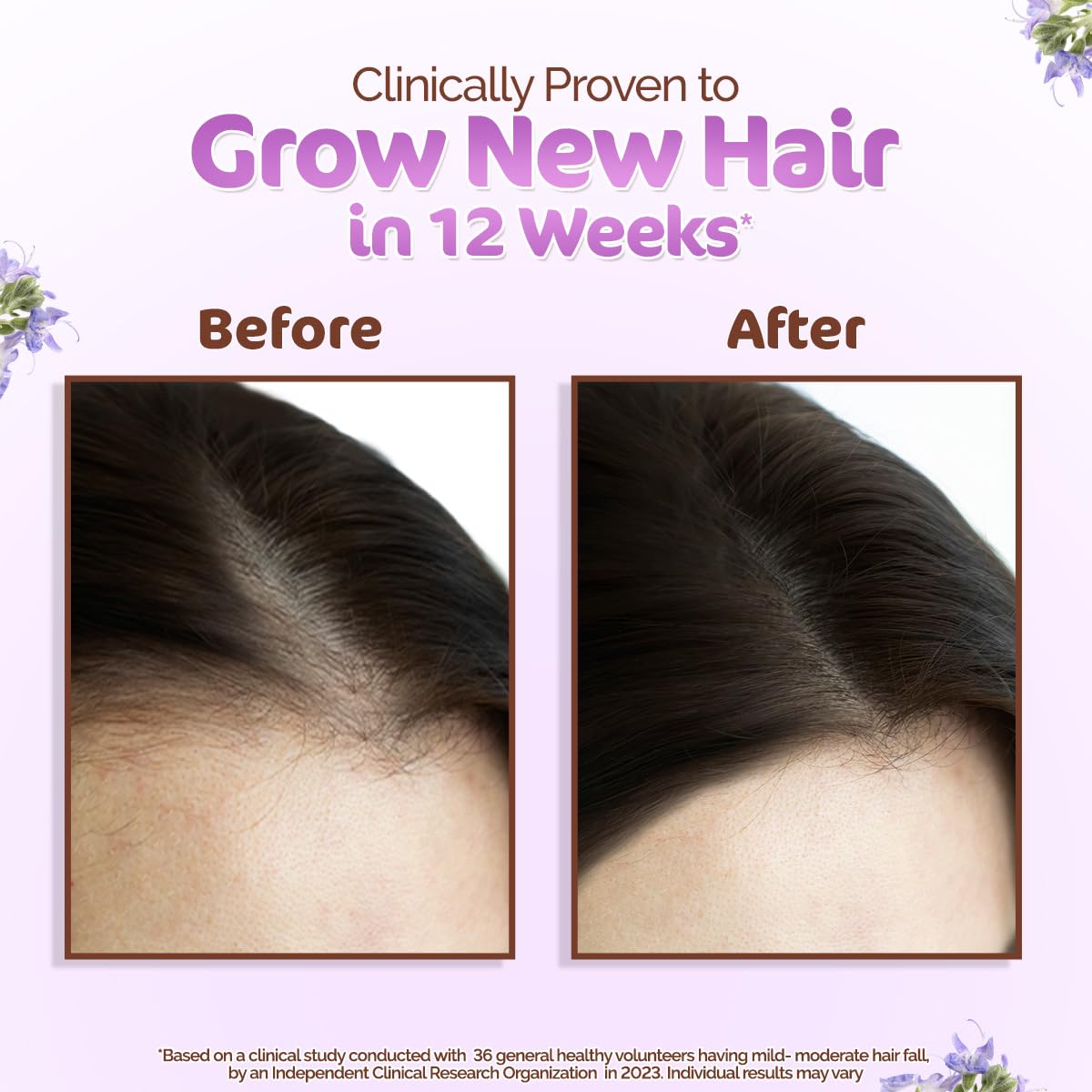 Mamaearth Rosemary Hair Growth Oil 150 ml