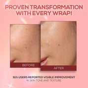 RENEE Pink Therapy Collagen Night Wrapping Face Mask, 20 ml | For Young, Hydrated Skin, Texture & Elasticity, Improves Skin Barrier, Hyaluronic Acid & Niacinamide Infused