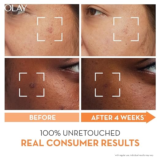 Olay Vitamin C Face Cream with Niacinamide l Even Glow & Smooth Texture l Normal, Oily, Dry & Combination Skin l Parabens & Sulphate-free l 50g