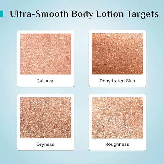 Pilgrim French Red Vine & Hyaluronic Acid Ultra Smooth Body Lotion | 48H Moisturization | Body lotion for dry skin | Infused With Shea Butter | For All Skin Types 400ml (400ml, Red Vine Ultra Smooth Body Lotion)