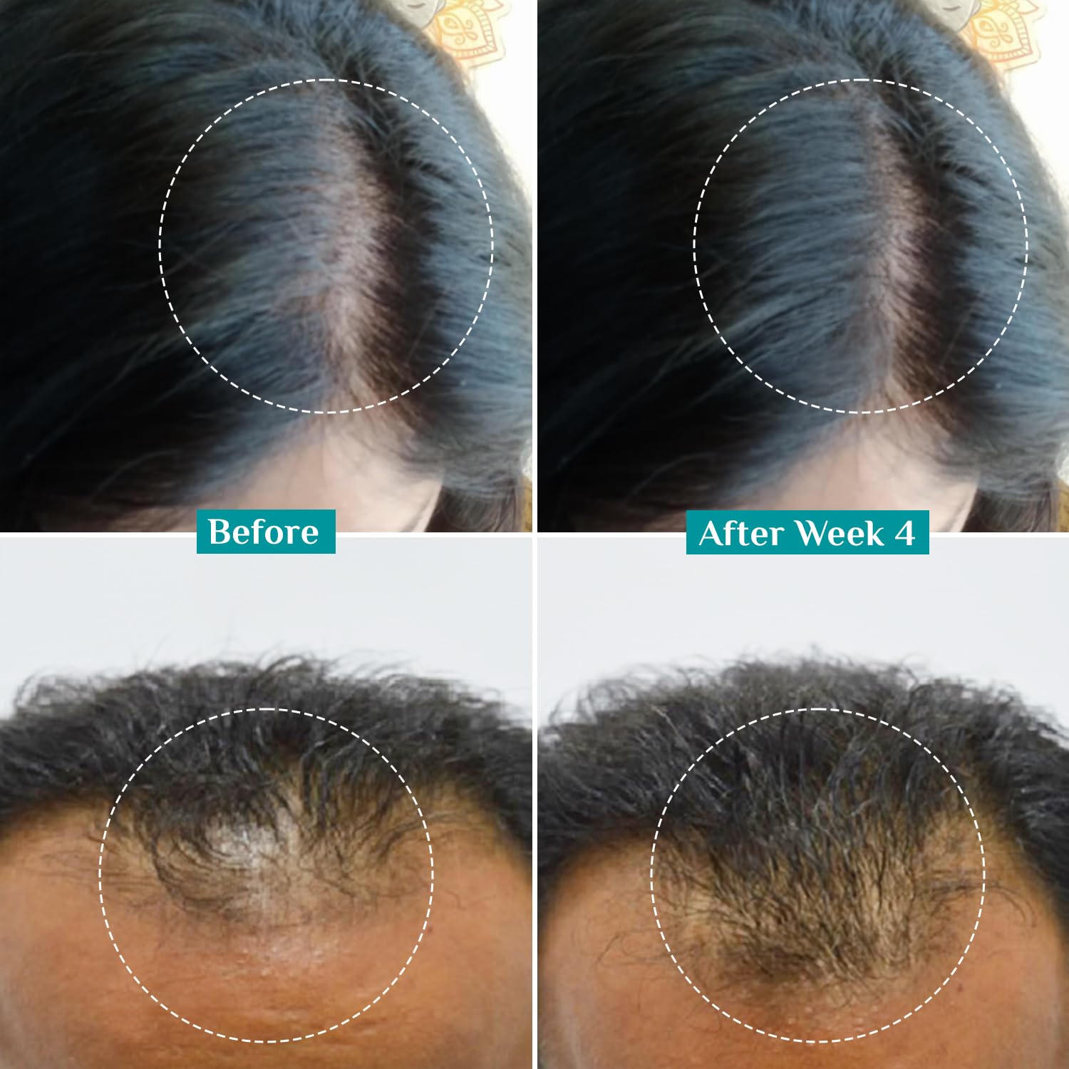 Pilgrim Redensyl 3% + Anagain 4% + Baicapil Advanced Hair Growth Serum