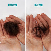 Pilgrim Spanish Rosemary & Biotin Anti Hairfall Shampoo for Reducing Hair Loss & Breakage 200ml