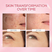 RENEE Pink Therapy PDRN Pink Peptide Face Serum For Glowing, Radiant Skin | Hydrates, Boosts Collagen, Evens Skin Tone | Lightweight, Quick Absorbing | Hyaluronic Acid & Niacinamide Infused | 30 ml