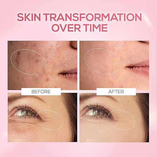 RENEE Pink Therapy PDRN Pink Peptide Face Serum For Glowing, Radiant Skin | Hydrates, Boosts Collagen, Evens Skin Tone | Lightweight, Quick Absorbing | Hyaluronic Acid & Niacinamide Infused | 30 ml