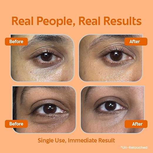 Rivona Naturals 2-in-1 Tinted Eye Cream with Concealer | Bakuchiol, Copper Peptides & Niacinamide | Reduces Dark Circles, Puffiness & Fine Lines | Natural Retinol Formula with Mineral Sunscreen | Instant Brightening No-Makeup Look | 15ml