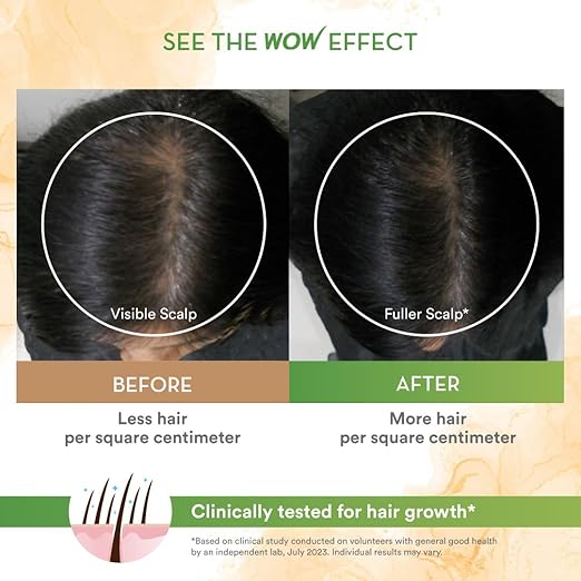 WOW Skin Science Rosemary with Biotin Hair Growth Oil